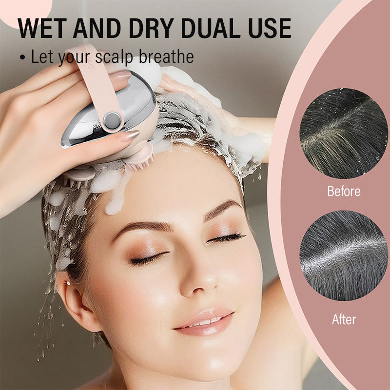 Milaniss™ ZenHead Therapy -🔥 At home head spa therapy device